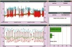 METSO REFORÇA GANHOS COM TECNOLOGIA EXPERTUNE